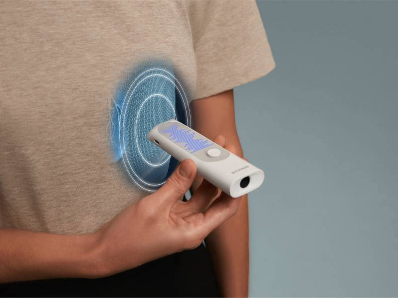 Withings BeamO: cómo usar el dispositivo para saber el estado de los pulmones.
