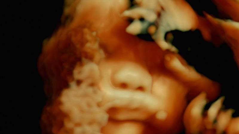 Las Favoritas de Albert Serra - imagen de feto