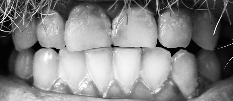 Primer plano de dientes humanos