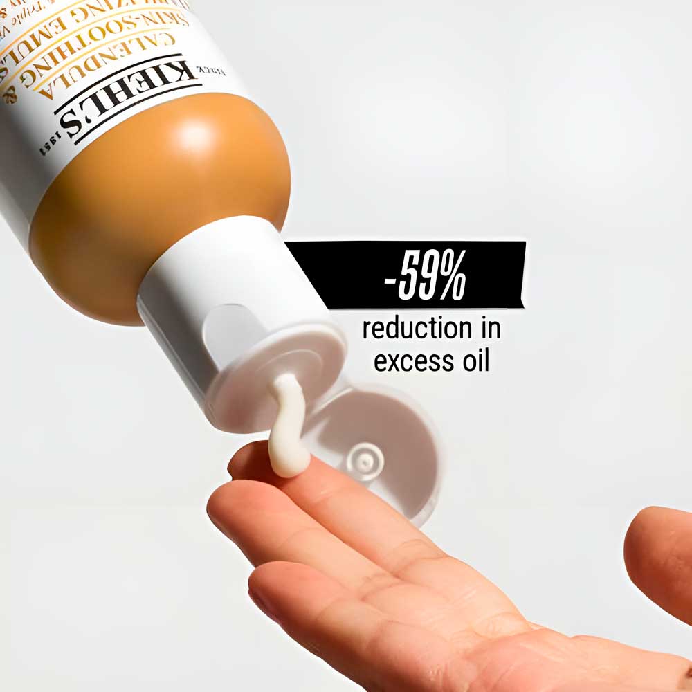 Acné adulto hormonal: cómo tratarlo sin sobrecargar la piel